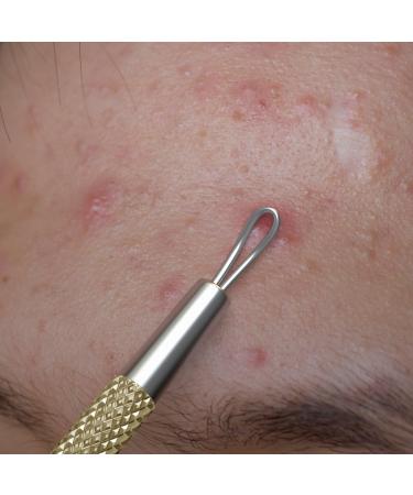 SC-11103-GLD Suvorna Whitehead Remover | Effective Pimple & Cyst Removal Tool for Clear Skin - Buy Online on GoSupps.com