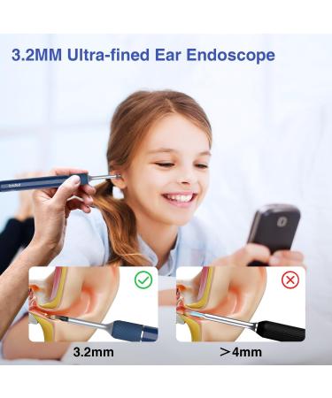 Buy Bebird Note 5 Ear Wax Removal Tool with Camera - 3 in 1 WiFi Ear Cleaner & Otoscope | International Shipping Available - Buy Online on GoSupps.com