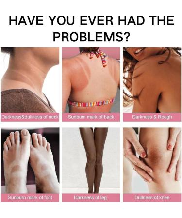 Whitening Body Cream - Body Lotion for Dry Skin - Body Moisturiser for Women - Fade Melanin on Body Armpit Knees Elbows - Skin Lightening Cream - Buy Online on GoSupps.com