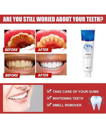 Smile Doctor SP-4 Probiotic Whitening Toothpaste - Ultra Whiten & Fresh Breath | 2 Pack - Best Stain Removal for Healthy Teeth - Buy Online on GoSupps.com