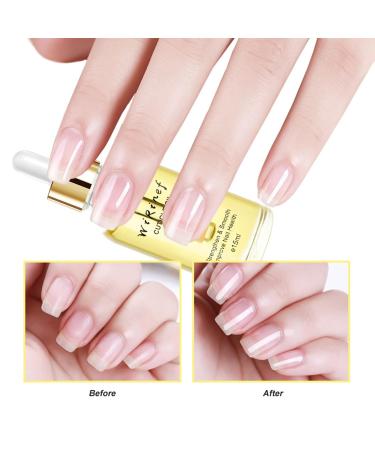 Nail Cuticle Oil - Strengthening & Nourishing Nail Care Oil for Healthy Nails & Cuticles | Vitamin E Formula with Pipette for Hands & Feet - Buy Online on GoSupps.com