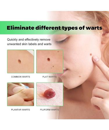 (100% Effective) 2PCS SmoothSkin Soap | Natural Aloe Vera Soap | Natural Smoothskin Soap | Moisturizing Instant Blemish Soap for All Skin Type | 100g/3.52fl.oz - Buy Online on GoSupps.com