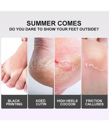 Foot Peel Mask For Hard Skin 2 Pairs Lavender Exfoliating Foot Mask Peel For Dead Skin Plant Formula Moisturising Brightening Socks Callus Remover Foot Mask Baby Soft Smooth Touch Feet - Buy Online on GoSupps.com