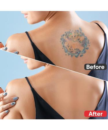 Invisible Waterproof Tattoo Cover Up Tape for Scars & Tattoos - 12Pcs - Buy Online on GoSupps.com