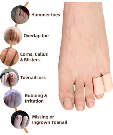 Hoogoo Pinky Toe Caps - 10 Pcs Silicone Small Toe Protector Cover Sleeves | Relief from Corns, Blisters, Sores | Reduce Friction & Rubbing - Buy Online on GoSupps.com