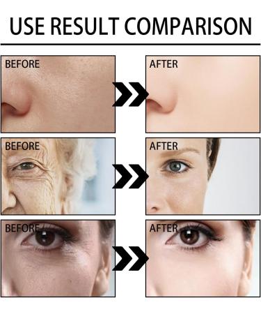 Snail Mucin Face Cream - Moisturiser Face Women - Snail Mucin Moisturiser - Face Moisturizer for Women - Long Lasting Moisturiser - Deep & Intense Hydration for Dry Skin - Mucin Secretion Filtrate 92% - Buy Online on GoSupps.com