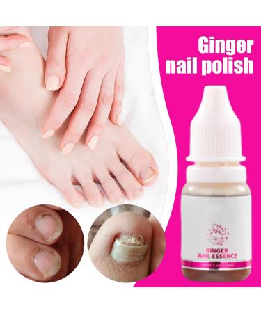 Nail Softener - Nail Strengthening Oil 10ml - Moisturizing Repair Care Nails Hands And Feet Sensitive Skin Men Women Daily Use Night Travel Manicure Pedicure - Buy Online on GoSupps.com