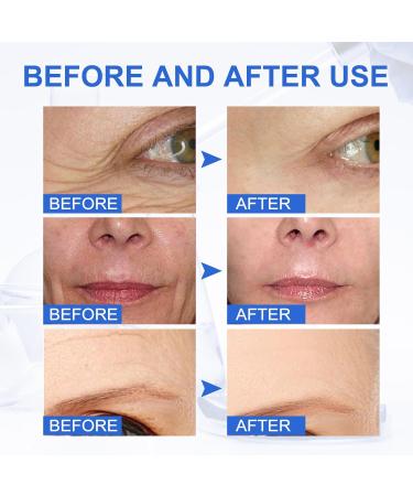 Buy Botox Stock Solution Facial Serum - Anti Aging with Collagen Hyaluronic Acid & Vitamin C for Intense Hydration | 2 Fl Oz - Buy Online on GoSupps.com