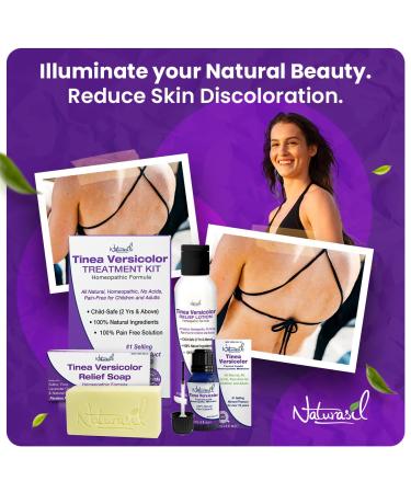 Tinea Versicolor Treatment Pack by Naturasil | Fast Relief for Skin Discoloration & Itching | 4oz Lotion 4oz Soap 15ml Oil | Treats Candida Jock Itch & Ringworm - Buy Online on GoSupps.com
