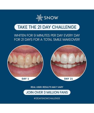 Snow Teeth Whitening Kit with LED Light | Complete At-Home Whitening System - Buy Online on GoSupps.com