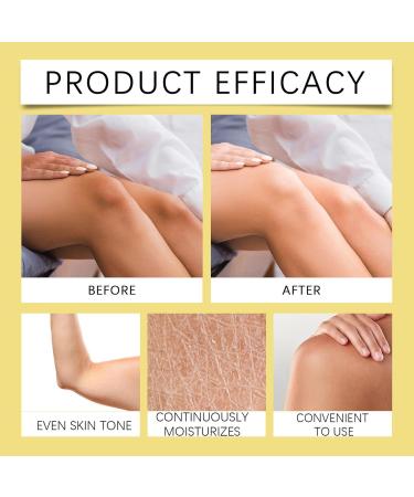 Skin Care 5days Dark Knuckle Remover Whitening Cream Anti Spot Face Cream Dark Spot Correcting Serum- Skin Brightening Gel Cream for Sun Spots with Hyaluronic Acid Vitamin E (2) - Buy Online on GoSupps.com