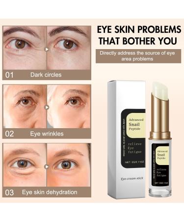 2PCS Turmeric Eye Balm Stick for Under Eyes Bags 2025 New Turmeric Cream Erases Eye Bags Within Minutes Moisturizing Under Eye Balm for Travel Care Serum for Women - Buy Online on GoSupps.com