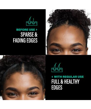 Unrefined Batana Oil for Hair Growth - Authentic Dr Sebi Batana Hair Mask - Organic Natural Hair Growth Oil - 4 oz from Honduras - Buy Online on GoSupps.com