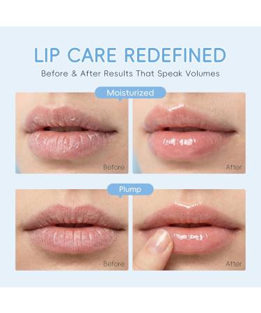 Milk Lip Care Set Hydrating Lip Care Kit with Lip Sleeping Mask Lip Balm & Lip Mask Patches Lip Repair Treatment with Vitamin E for Dry Chapped Lips Reduces Lip Lines for Women & Girls - Buy Online on GoSupps.com