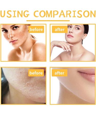 EXQST Lightening Turmeric Scrub for Dark Spots Natural Exfoliating Salt for Body and Face Natural Turmeric Scrub for Dark Spots Smoothing Exfoliator for Underarms - Buy Online on GoSupps.com