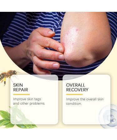  LinBomZony Bee Venom Skin Cream-Anti-aging Face Moisturizer for Women and Men Gel for Treatment of Bee Venom Deep Moisturizing for All Kinds of (2PCS) - Buy Online on GoSupps.com