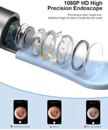 Buy TOKNOOME Ear Wax Removal Kit - 1080P Visual Ear Cleaner with Camera 6 Ear Picks & Spoons for iOS & Android - International Shipping Available - Buy Online on GoSupps.com