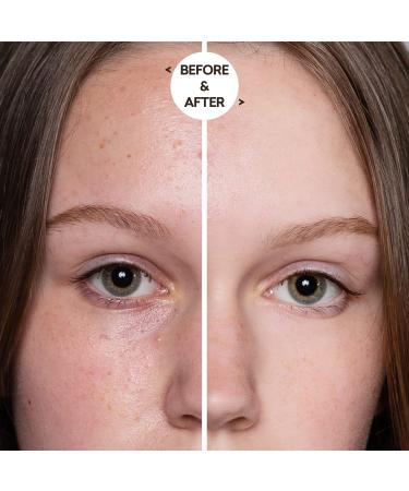 Just Nutritive Acne Clear Face and Body Wash 16 Oz | Adult Acne Treatment and Cleanser - Buy Online on GoSupps.com