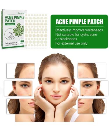 Nmbol Acne Patch Colorful 3 - Buy Online on GoSupps.com