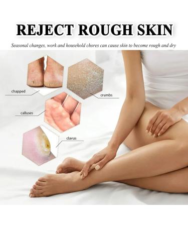 Urea 42% Foot Cream Cracked Heel Repair Cream For Feet and Hand Callus Remover For Dry And Hard Skin Hydrating Foot Moisterizer Nourishes Soften for Feet Knees Hand 100g - Buy Online on GoSupps.com