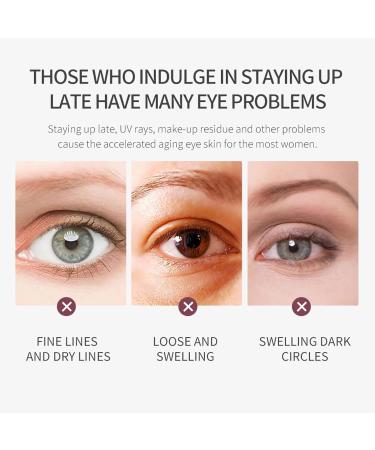 mercham Retinol Eye Cream Anti Aging Under Eye Cream with Cooling Roller for Dark Circles and Puffy Eyes Bags Reduce Fine Lines Brightening & Moisturizing Eye Repair Cream for all Skin Types- 20g - Buy Online on GoSupps.com