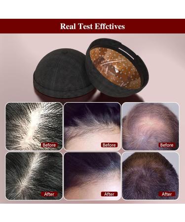 Jitesy Laser Therapy Cap - 236 Probes Red-Blue-Light Hair Growth System for Thinning Hair & Androgenetic Alopecia Treatment - Fast International Shipping - Buy Online on GoSupps.com