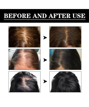 Rennora Hair Growth Serum - Organic Hair Growth Oil for Black Women Fast Results for Thinning & Hair Loss - Buy Online on GoSupps.com