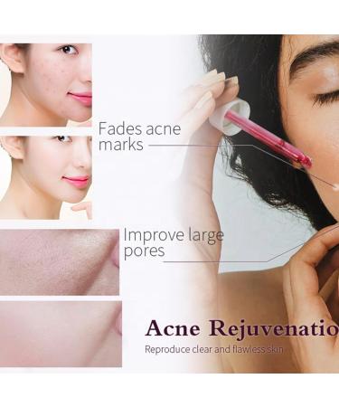 Buy AHA 30% + BHA 2% Exfoliating Facial Serum | Generic Peeling Solution for Blemishes & Pore Congestion - 1.0 Fl Oz/30ml (2 PCS) - International Shipping Available - Buy Online on GoSupps.com