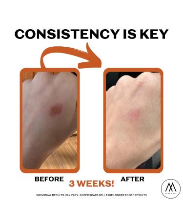 Motivo Advanced Scar Care Bundle - Scar Tape & Roller Serum (10ml) | Water & Sweat Resistant | Suitable for All Skin Types | Ideal for Surgical, C-Section, Trauma & Acne Scars - Buy Online on GoSupps.com