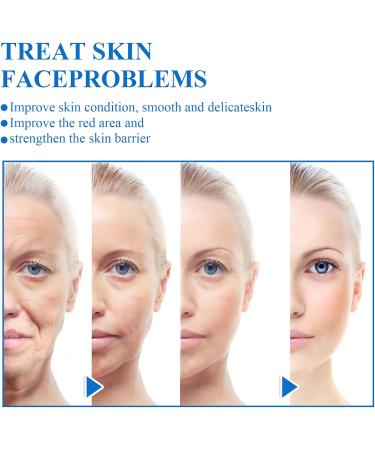 Bo-Tox Set of 3 immediate effect serums for the face B-Otox Face serum B-Otox Stock Solution Bo-Tox Stock Solution anti-aging Anti-aging serum Dark spot corrector serum Aniston Serum - Buy Online on GoSupps.com