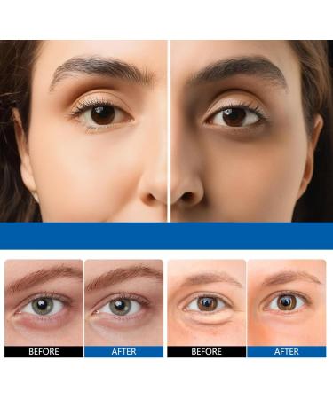 Cr me anti cernes et rides instantan cernes sous les yeux homme et femme cr me Anti Poche Sous les Yeux Cremes Liftante Anti Ride removes bags dark circles Korean Skincare 50ml (1) - Buy Online on GoSupps.com