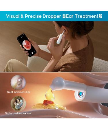 BEBIRD Home 30S Ear Care System - Advanced Ear Cleaner with FHD Camera & UVC Light | Complete Earwax Removal Kit for Adults & Kids - Buy Online on GoSupps.com