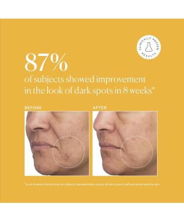 Naturium Tranexamic Acid 5% Skin Discoloration Treatment with Kojic Acid, Niacinamide & Licorice Root - 1 oz - Buy Online on GoSupps.com