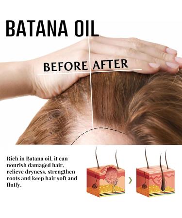 Batana Oil for Hair Growth Batana Oil Organic for Healthy Hair Deeply Nourishing Scalp Roll-On Hair Growth Essence Nourishes Thin Hair Scalp Skin and Loss Hair Growth Fir for All Hair Types - Buy Online on GoSupps.com