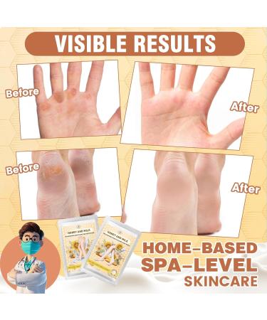 Hydrating Hand & Foot Mask Set - 3 Socks & 3 Masks for Moisturizing Dry Skin Cracked Heels - Nourishing Honey Milk & Vitamin E Treatment - Buy Online on GoSupps.com