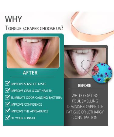 RONAVO Copper Tongue Scraper for Adults | Oral Care & Hygiene Tongue Cleaner for Fresher Breath | Includes Travel Case - Buy Online on GoSupps.com