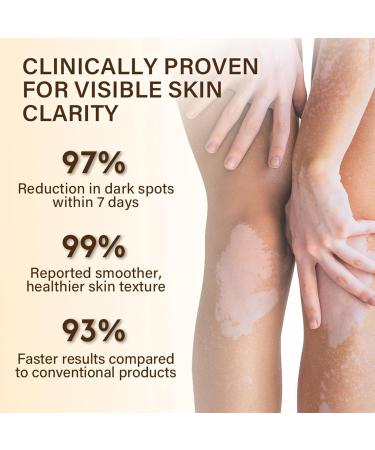 Oveallgo Viticlear Bee Venom Cream Professional Vitiligo Cream Bee Venom Skin Treatment cream Reduce White Spots and Improve Skin Pigmentation Natural Serum Suitable for All Skin Types (2 Pack) - Buy Online on GoSupps.com