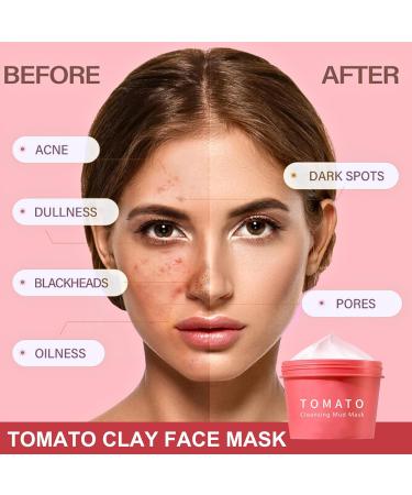 Tomato Clay Face Mask Clay Mask for Pores Moisturizing Clay Mask Controlling Oil Mud Mask for Deep Cleansing Exfoliating Facial Mask Remove Acne & Refining Pores Reduce Blackheads & Dark Spots - Buy Online on GoSupps.com