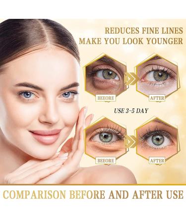 Danvisit 24K Gold Under Eye Patches - 60 Pcs Wrinkle Treatment for Women, Dark Circles & Puffiness Removal - Buy Online on GoSupps.com