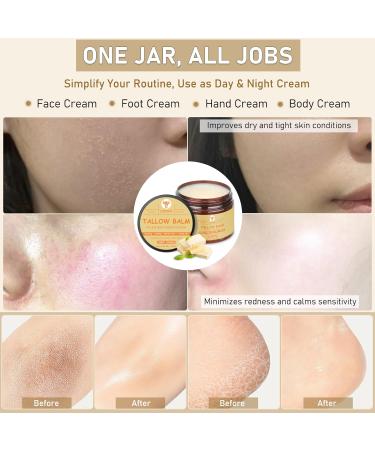 Beef Tallow for Face (5.29 Oz) | 100% Grass-Fed Beef Tallow Balm for Dry & Sensitive Skin - Organic Beef Tallow for Skin - Tallow Face Moisturizer - Deep Hydration & Soothing Relief (Sweet Orange) Sweet Orange 5.29 Ounce (P  - Buy Online on GoSupps.com
