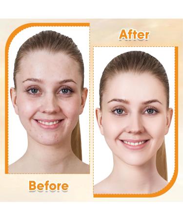 Vitamin E Rose Oil & Gua Sha Massage Tools Set - Organic Moisturizing Oil for Face Body Anti-Aging & Joint Relief - 4 oz - Buy Online on GoSupps.com