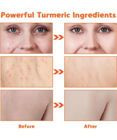 Turmeric Soap Bar Handmade Tumeric Soap Organic Turmeric Brightening Soap for All Skin Types Natural Soap for Cleansing Unclogs Pores Deep Cleaning - Buy Online on GoSupps.com