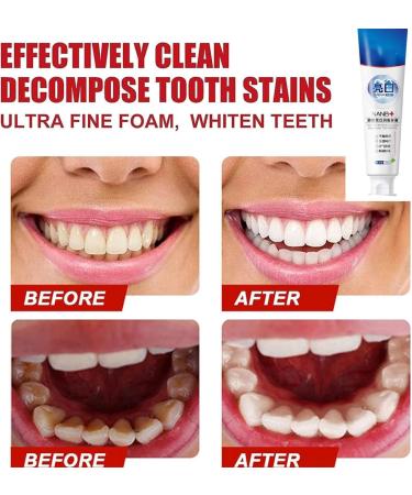 NANB Probiotic Rapid Whitening Toothpaste - Ultra Whiten Stain Removal for Fresh Breath - 2024 Formula | International Shipping Available - Buy Online on GoSupps.com