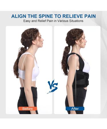 Adjustable Back Brace Posture Corrector for Men and Women - Breathable Support for Upper and Lower Back - Improve Poor Posture - Size Large - Buy Online on GoSupps.com