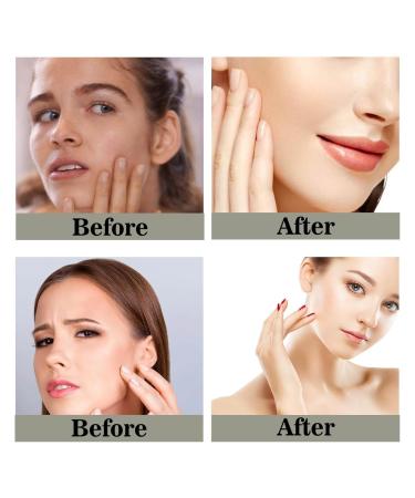 Beef Tallow Balm - Natural Moisturizer for Dry Skin | Whipped & Unscented Skin Care - 4 Oz - Buy Online on GoSupps.com