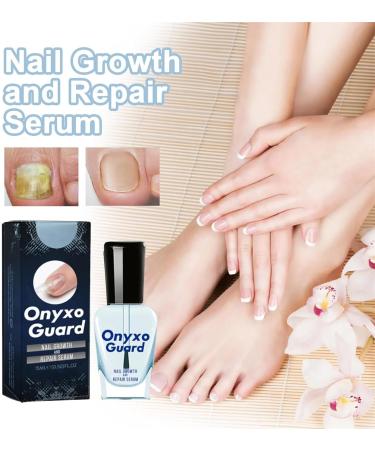 OnyxoGuard Nail Growth and Repair Serum Onyxoguard Serum Onyxoguard Nail Growth Serum Onyxoguard Nail Serum Nail Strengthener for Thin Nails and Growth (1pcs) - Buy Online on GoSupps.com