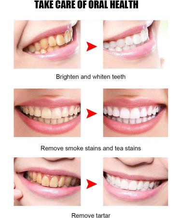 Electric Toothbrush Adults Portable Ultrasonic U-Shaped Toothbrushes for Teeth Whitening 360 Whole Mouth Cleansing Hands free Gums Care Sonic Toothbrushes Rechargeable IPX7 Waterproof - Buy Online on GoSupps.com