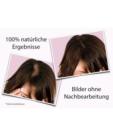 Fully Skull Spread Hair for Women - 27g Black Hair Fibers for Thin Hair & Hair Loss - Thickening Hair Solution - Buy Online on GoSupps.com