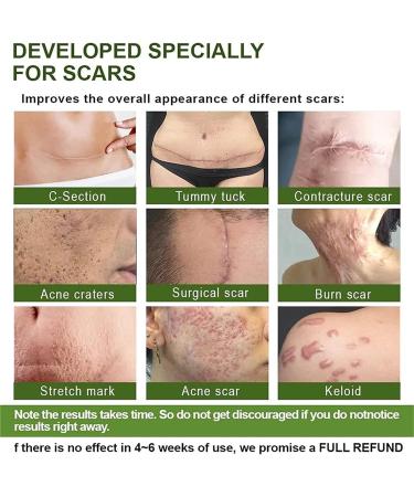 Goopgen Advanced Scar Repair Serum - Medical Grade Nature Treatment for All Types of Scars (Color 5pc) - Buy Online on GoSupps.com