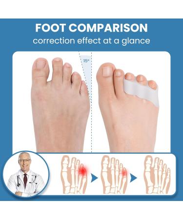 10 PCS Medium-Footed Gel Cushions & Toe Spreaders for Diabetic Comfort - Breathable Forefoot Pain Relief - Buy Online on GoSupps.com